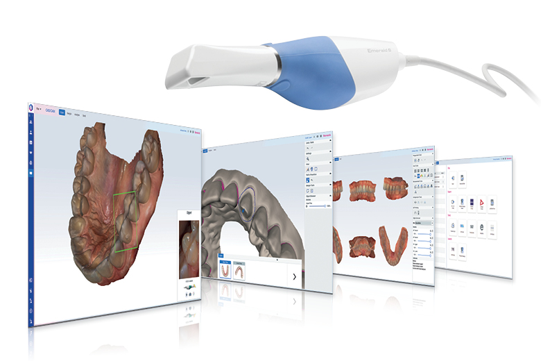 Das Modul Planmeca Romexis® CAD/CAM bringt digitale Abdrücke auf ein ganz neues Niveau